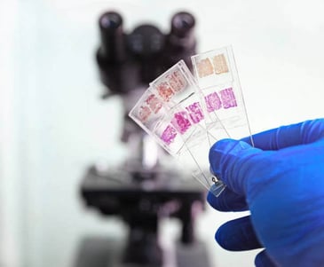 histology lab with samples on glass slides